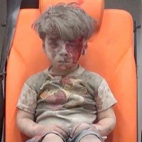 Bloody and Dusty Syrian Boy in Ambulance, 2016