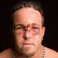 Joey Mercury's Face is Wrecked by a Ladder (12/17/2006)