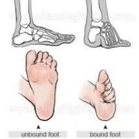 Lotus Feet